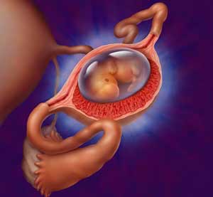 Ectopic Pregnancy02